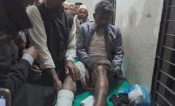  কুয়াকাটায় ‘যুবলীগ নেতার নেতৃত্বে’ ইউপি চেয়ারম্যানকে হাতুড়িপেটা